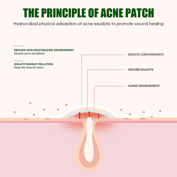 Pimple Patch